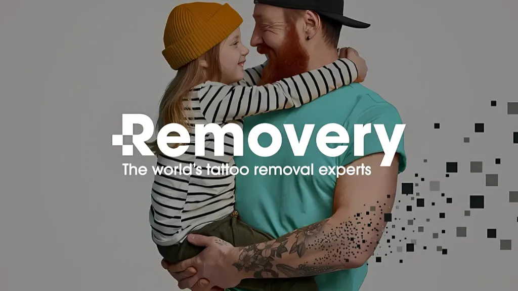 Removery Tattoo Removal & Fading — Tattoo removal service in King of Prussia